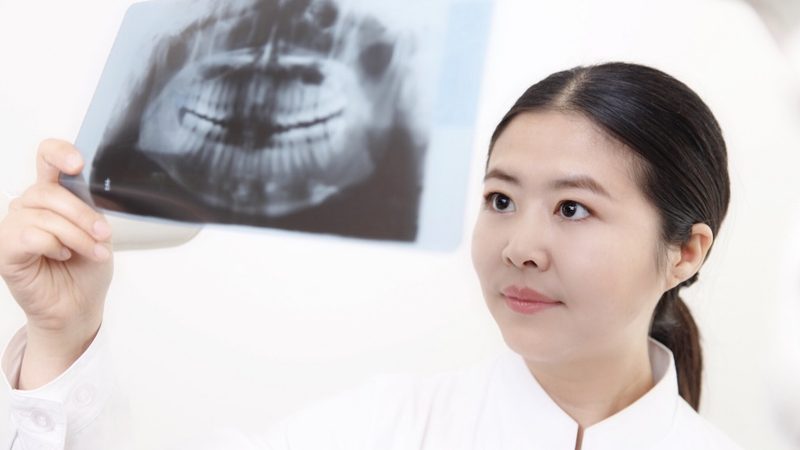 舌侧正畸：隐藏在牙齿背后的美丽蜕变**